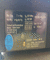 Scales 4815 02